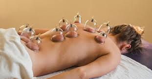 Cupping Therapy: Ancient Healing in the Modern World
